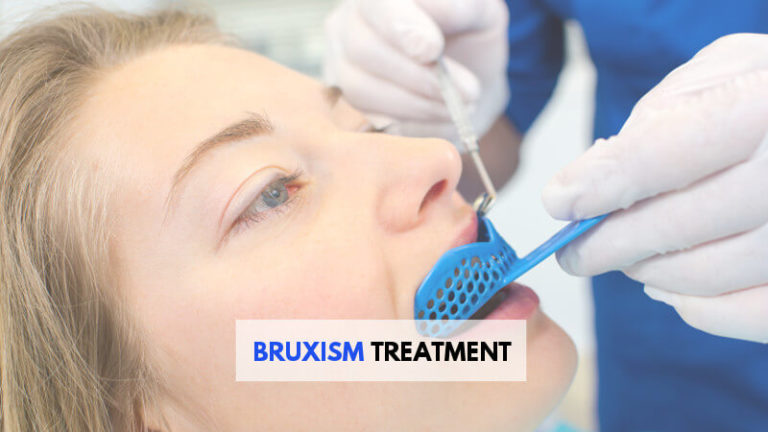 bruxism-treatment