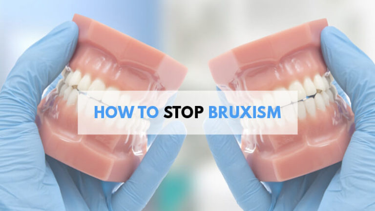 how-to-stop-bruxism-teeth-grinding