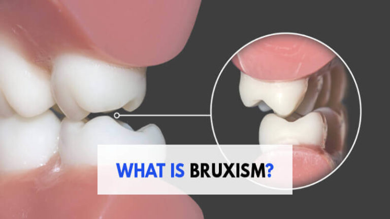 what is bruxism