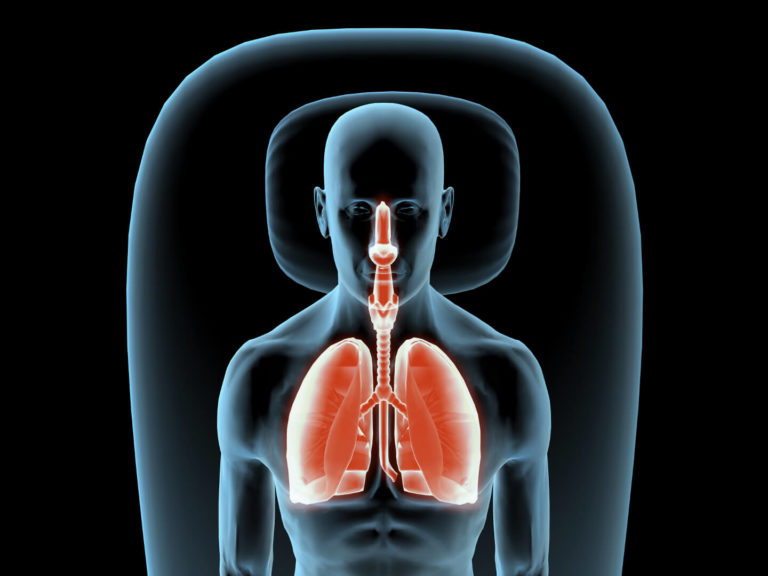 diagram-of-xray-lungs