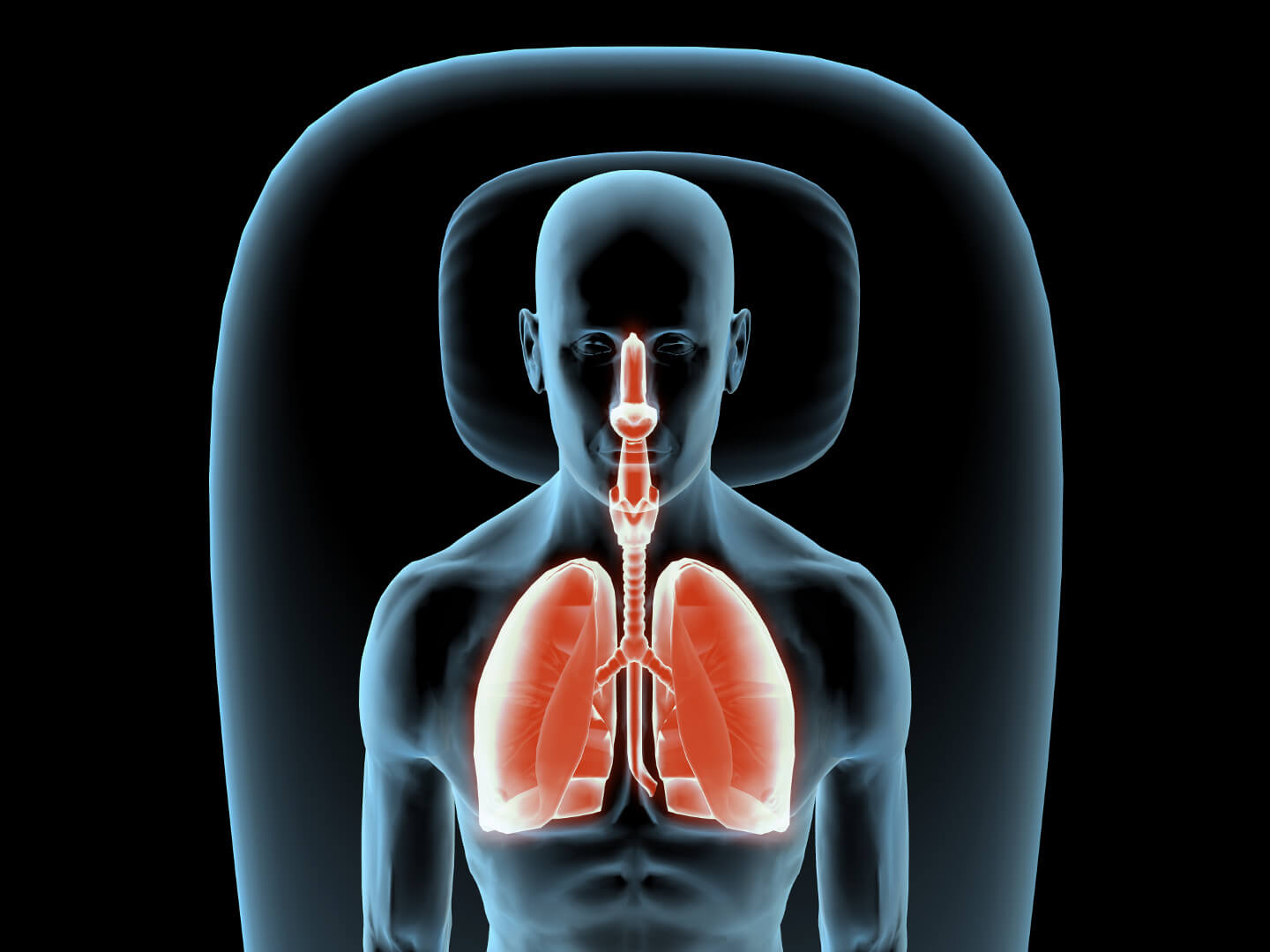 diagram-of-xray-lungs