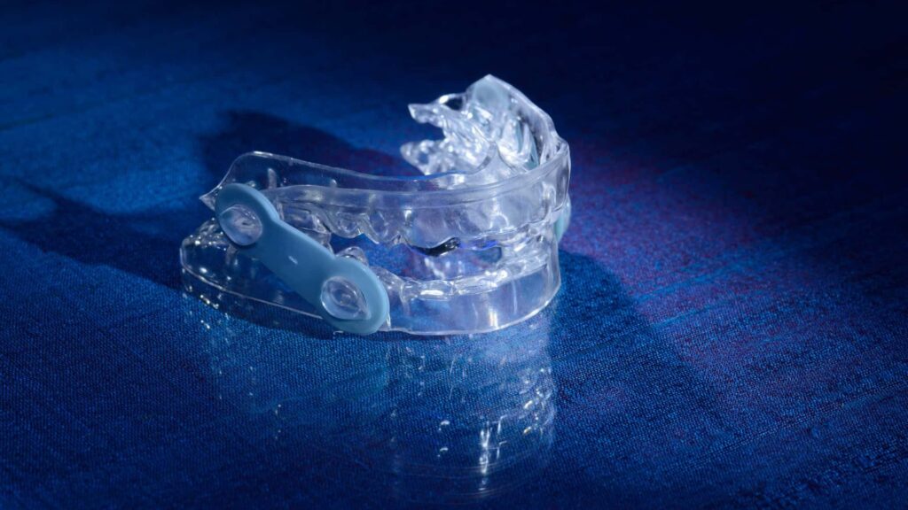 Clear mandibular advancement appliance with a blue connecting strap resting on a dark blue textured surface